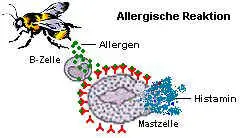 Massenhafte Ausschüttung von Histamin bei allergischer Reaktion vom Typ 1.
