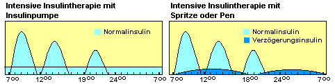 Intensive Insulintherapie mit Spritze, Pen oder Insulinpumpe.