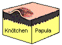 Kntchen bestehen aus vorgewlbter Haut.