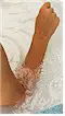 B�der helfen bei Narben an H�nden, F��en und Ellenbogen