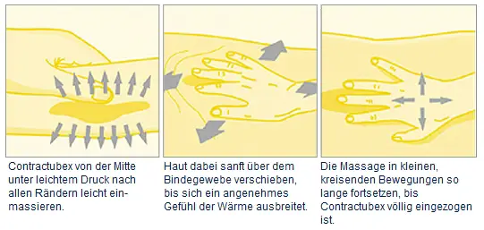Anwendungshinweise Contractubex