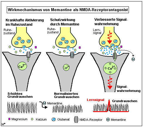 Wirkmechanismus von Memantine als NMDA-Rezeptorantagonist