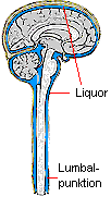 Bei einer Lumbalpunktion wir Liquor aus dem Rückenmarkskanal entnommen.