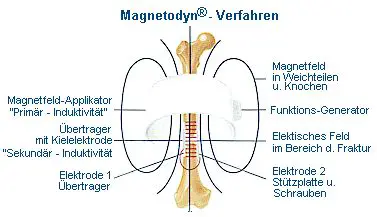Magnetodyn - Verfahren