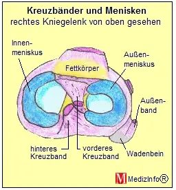 Kreuzbnder und Menisken des Kniegelenks