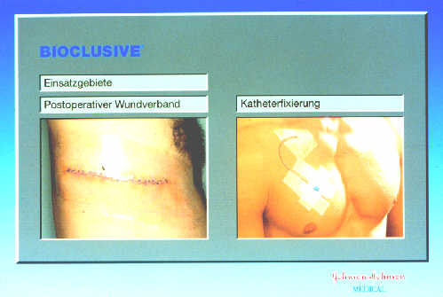 Klick liefert grosse Version des Bildes!