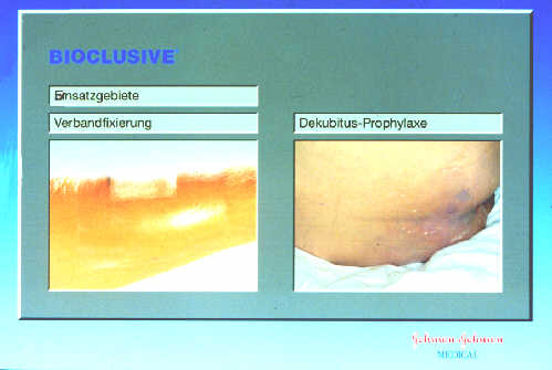 Klick liefert grosse Version des Bildes!