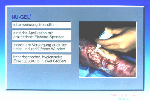 Klick liefert grosse Version des Bildes!