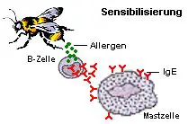 Bei der Sensibilisierung verbinden sich IgE-Antikörper mit der Mastzelle.