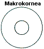 Makrokornea