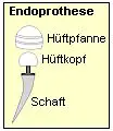Schematische Darstellung der Endoprothese