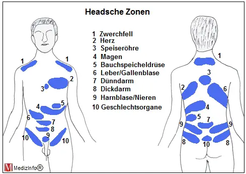 Die Headschen Zonen sind Hintergrund der Segmenttherapie bei funktionellen Herzbeschwerden
