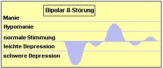 Phasen der Bipolar-II-Störung