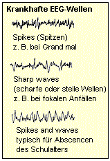 Beispiele krankhafter EEG-Wellen