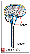 Medikamente werden direkt in den Liquorraum gespritzt