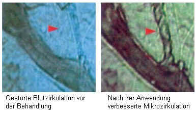 Intravital-Mikroskopie der verbesserten Mikrozirkulation durch BEMER
