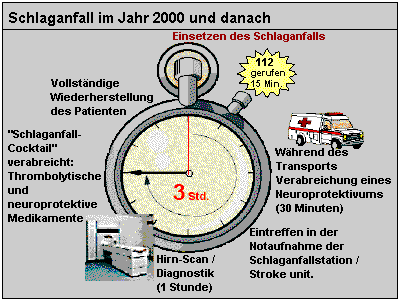 Zukunftsszenario: Schlaganfall im Jahr 2000