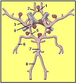 Hirn-Aneurysmen im Circulus arteriosus cerebri