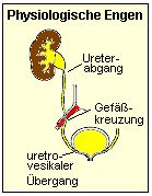 An den natrliche Engstellen bleiben oft Harnsteine hngen.