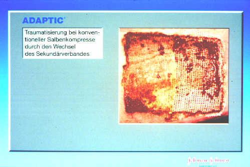 Klick liefert grosse Version des Bildes!