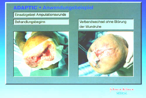 Klick liefert grosse Version des Bildes!